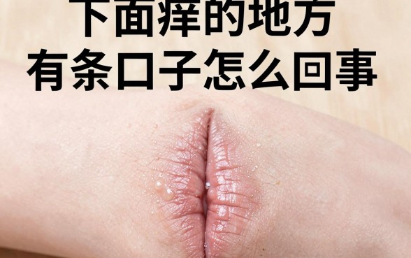 下面痒的地方有条口子怎么回事，下面痒裂口子是什么原因引起的