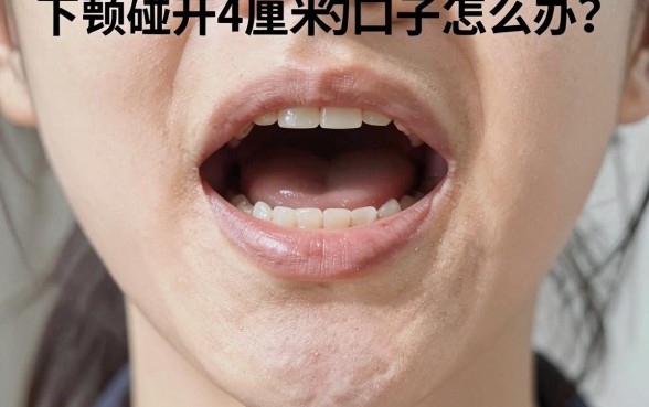 下颚碰开4厘米的口子怎么办？下颚受伤留疤怎么处理